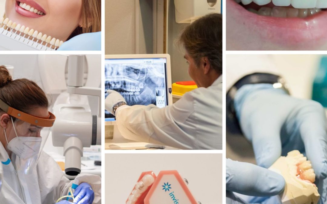 Estética dental en Vilafranca: mejore su sonrisa y su salud